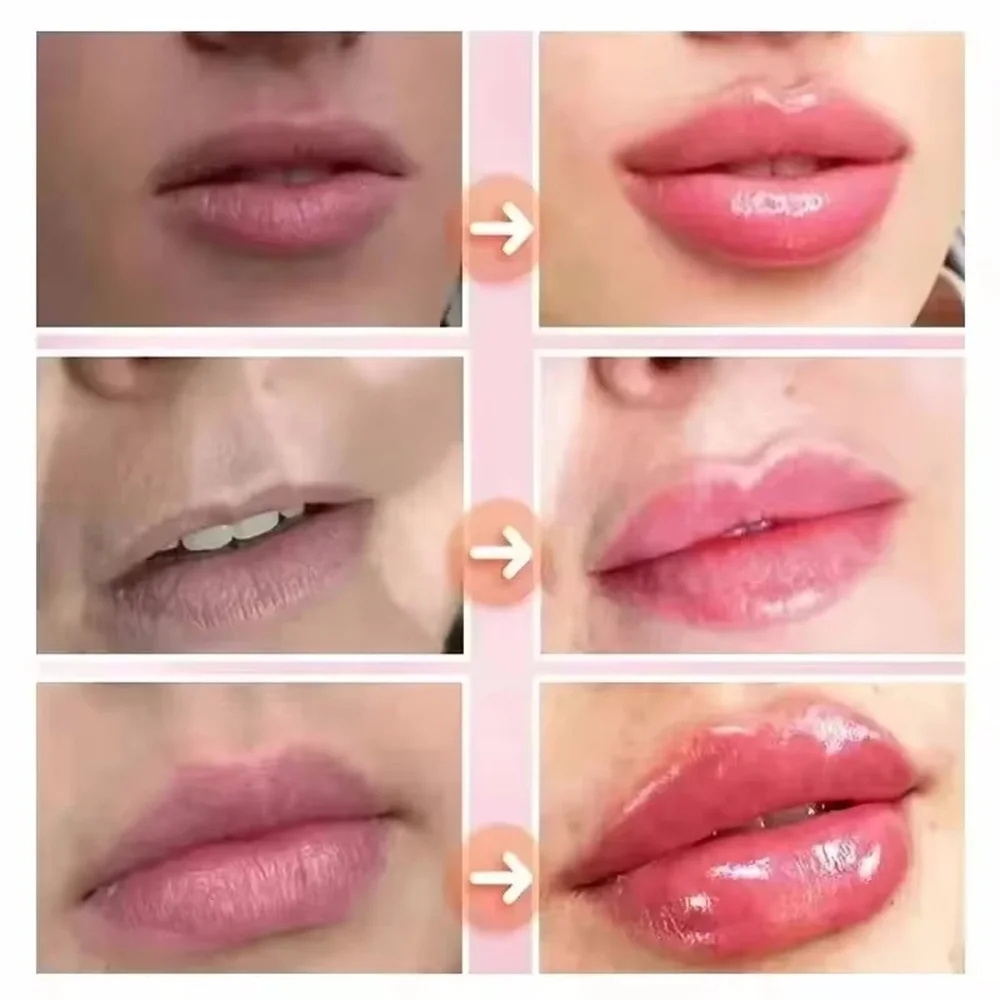 Быстродействующий увлажняющий  – обзор и цена Skincare Natur E