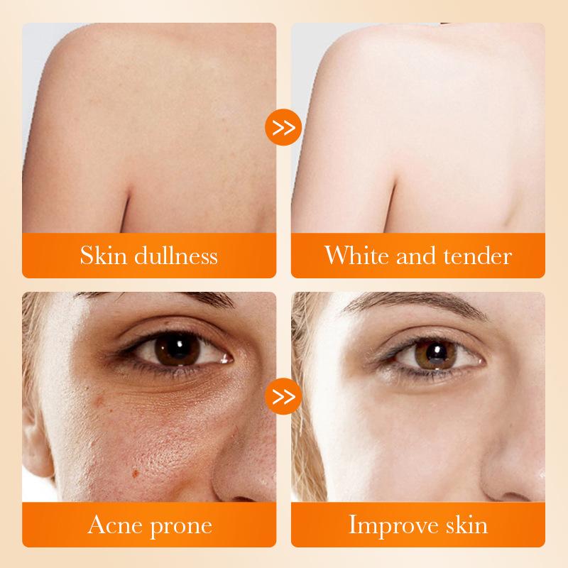 1 шт. Мыло для лица SADOER с к – обзор и цена Kojic Acid Soap