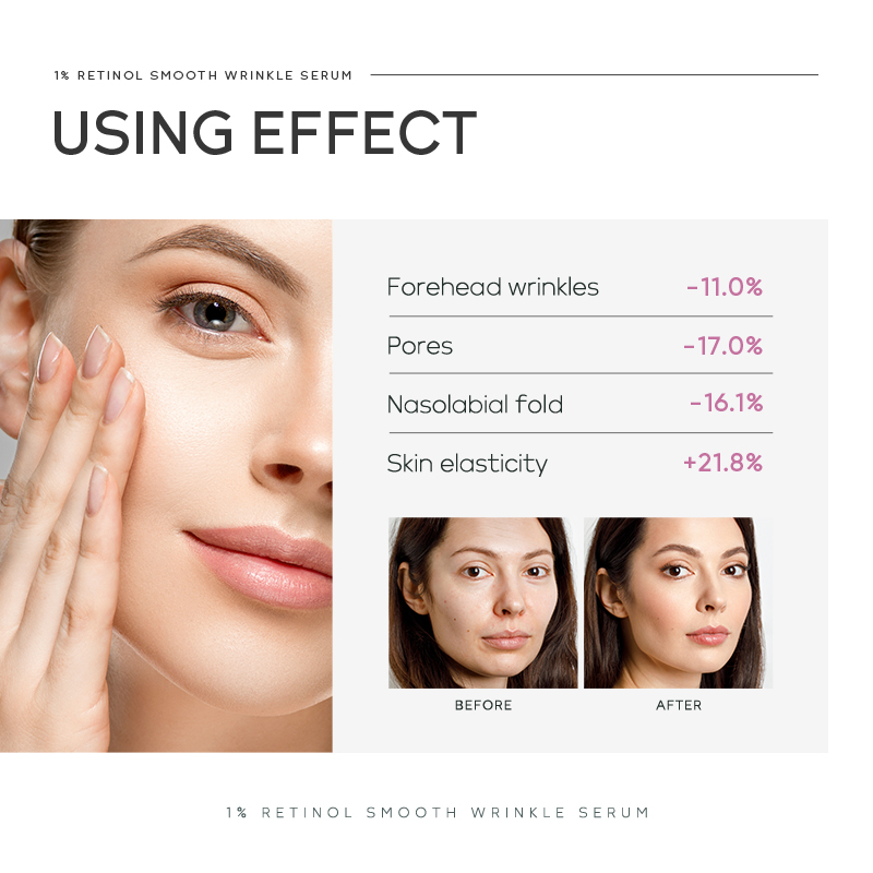 Сыворотка Quiyum 1% с ретиноло – обзор и цена The Ordinary Serum Hyaluronic Acid